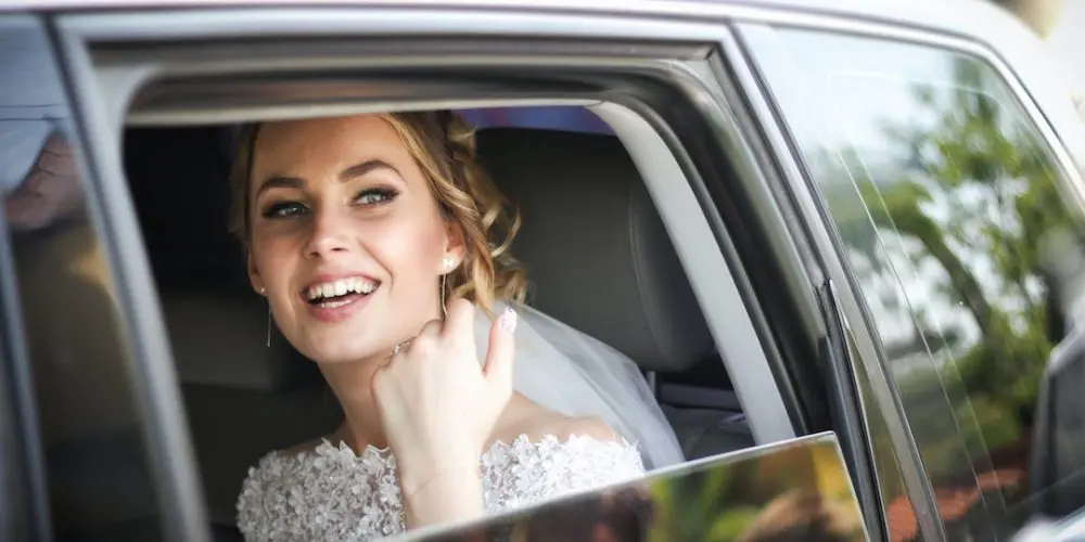 How to keep your teeth white for your wedding day