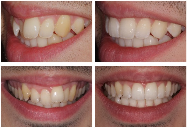 9 Things You Can Do to Get a Perfect Smile - Men's Health