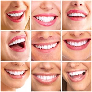 Is having straight teeth and a perfect smile really that important? Sloan Dental