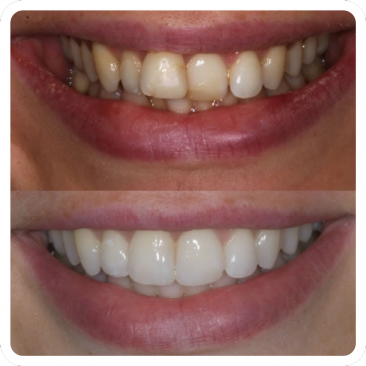 ORTH - Clear Aligners Sloan Dental