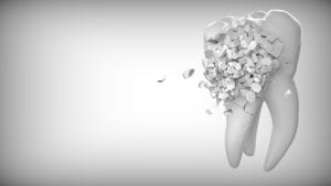 How to Deal with a Broken Tooth or Lost Crown at Home Sloan Dental