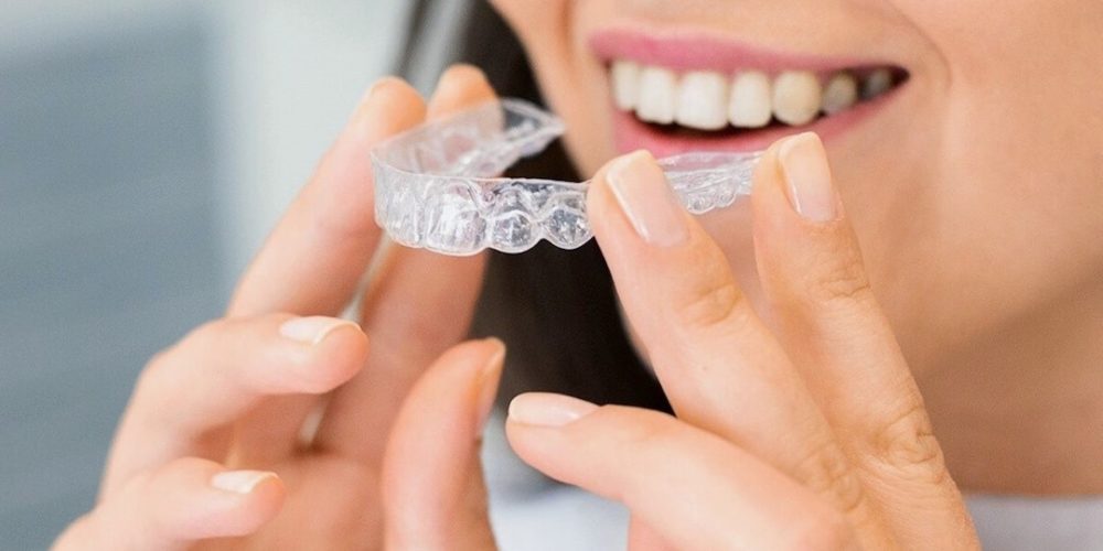 Remove Invisalign aligners