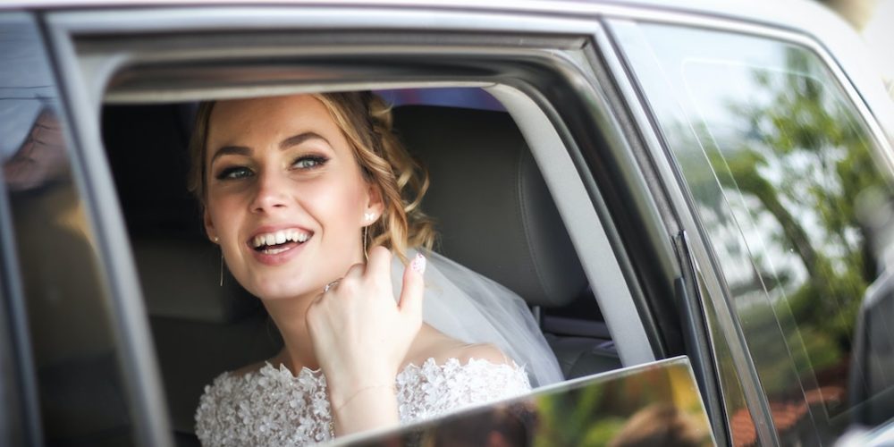 How to keep your teeth white for your wedding day